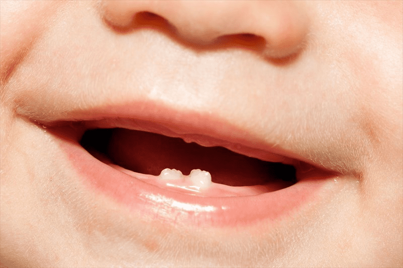 آیا ممکن است کودک دندان درنیاورد؟ تاخیردر رویش دندان نوزاد طبیعی است؟