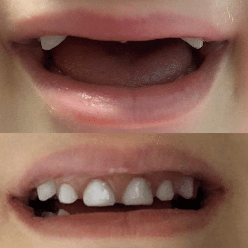 پروتزهای دندانی