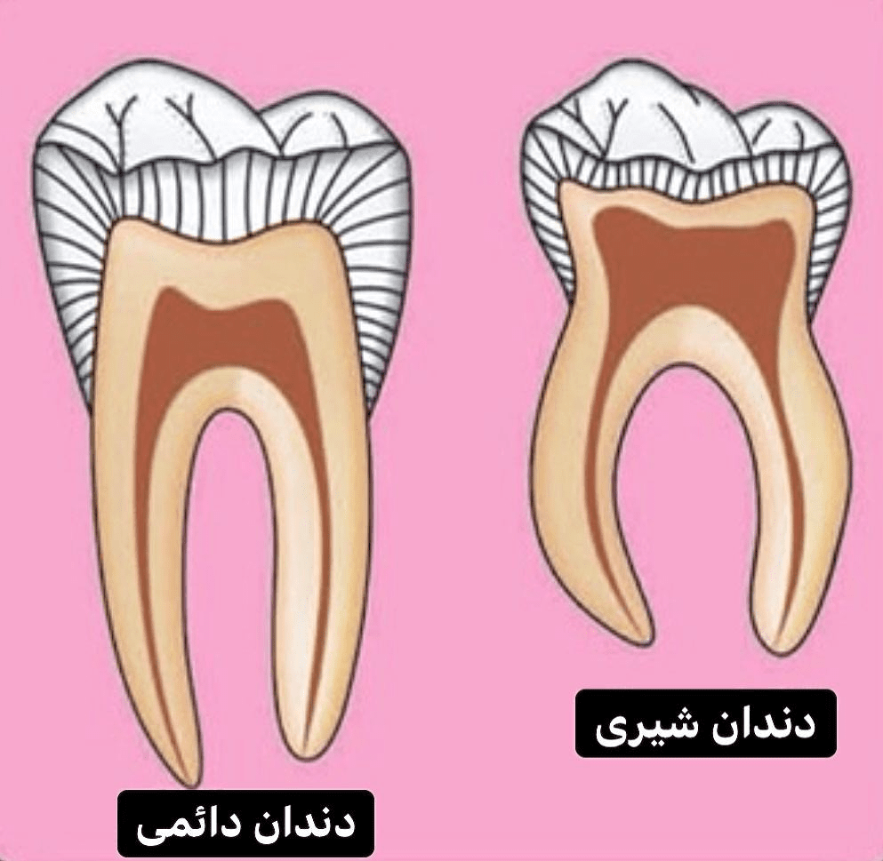 چه تفاوتی بین دندان دائمی و شیری وجود دارد؟